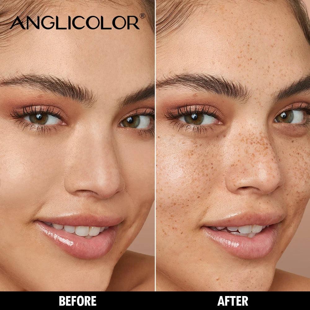 Original ANGLICOLOR Freckle Pen - 5-Prong Pen for a Naturally Radiant Freckle Effect